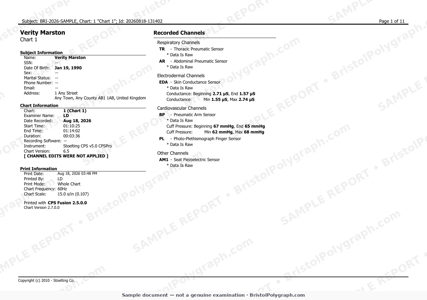 charts page 1 (sample, watermarked)